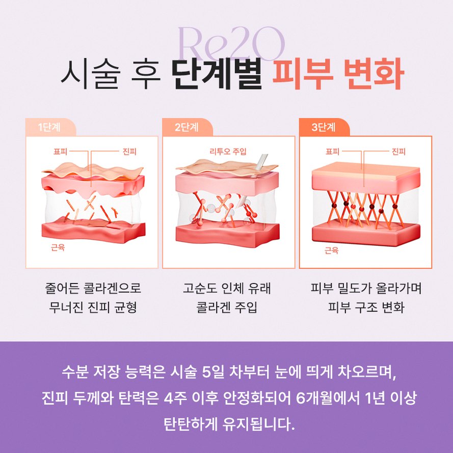본문 내용을 보조하는 이미지