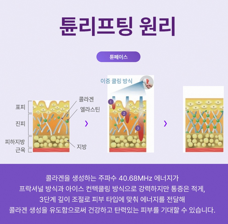 본문 내용을 보조하는 이미지