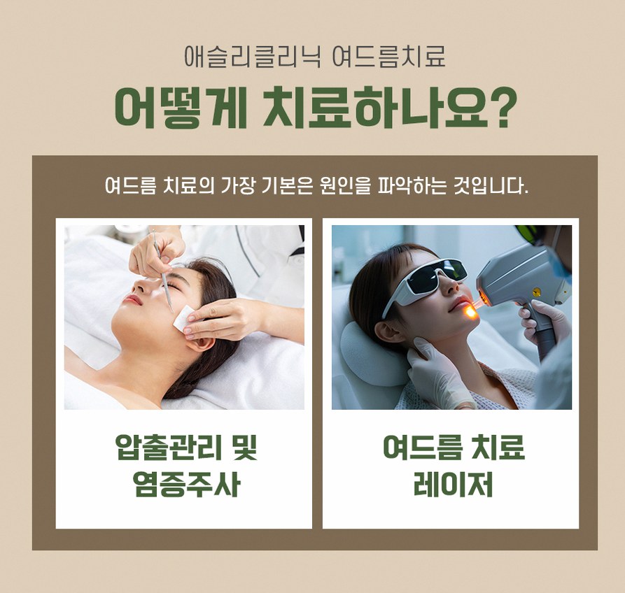 본문 내용을 보조하는 이미지