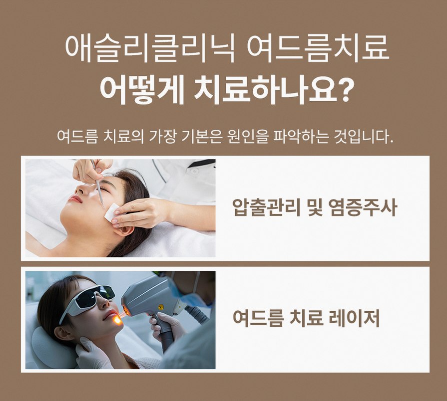 본문 내용을 보조하는 이미지