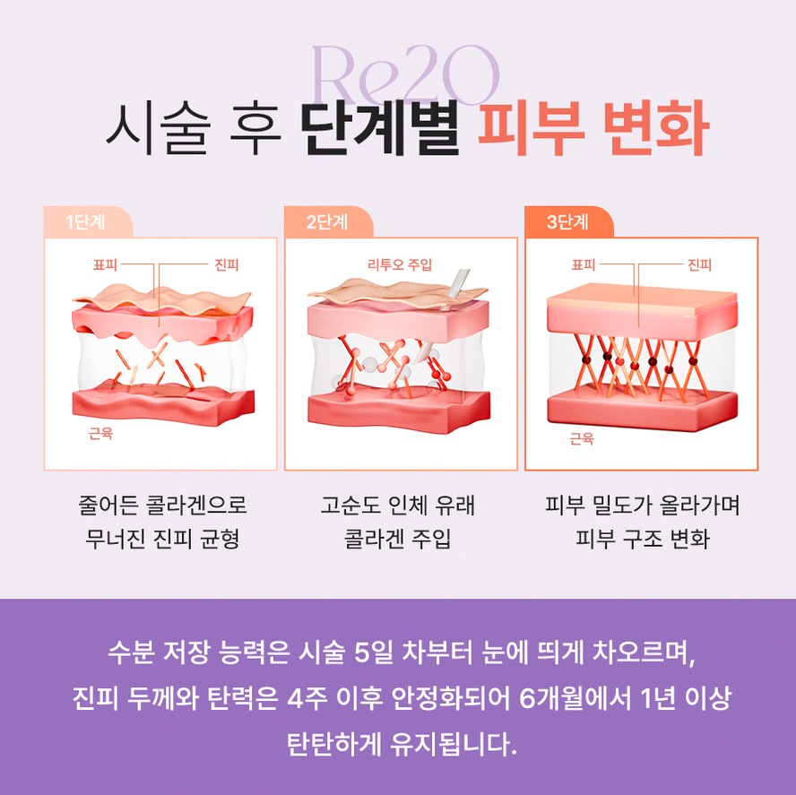 본문 내용을 보조하는 이미지
