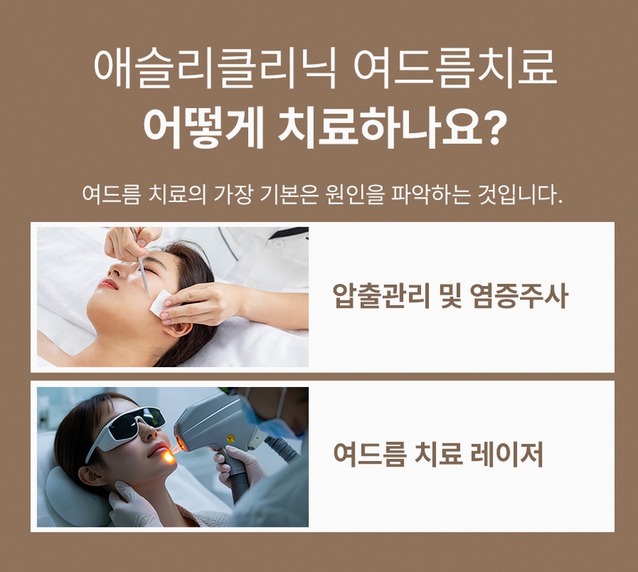 본문 내용을 보조하는 이미지