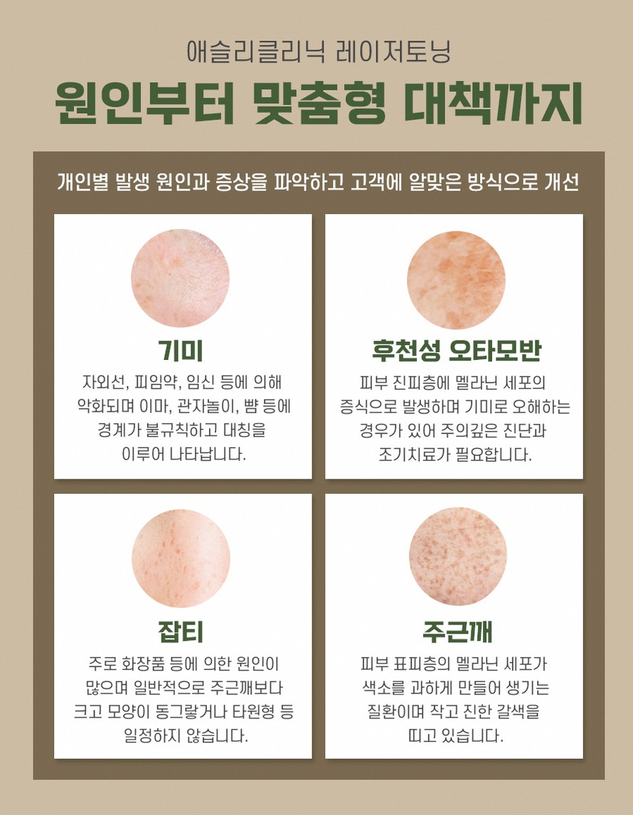 본문 내용을 보조하는 이미지