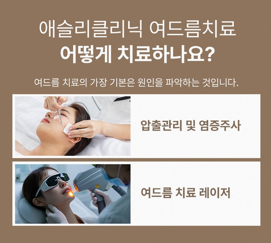 본문 내용을 보조하는 이미지