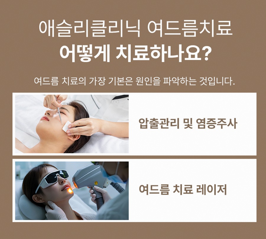 본문 내용을 보조하는 이미지