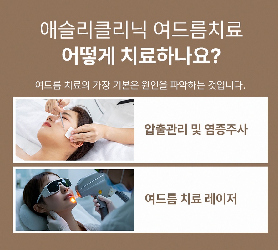 본문 내용을 보조하는 이미지