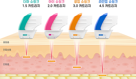 애슬리의원 탄력 리프팅 상세 안내 이미지