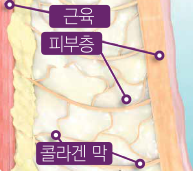 애슬리의원 탄력 리프팅 상세 안내 이미지