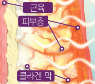 애슬리의원 탄력 리프팅 상세 안내 이미지