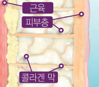 애슬리의원 탄력 리프팅 상세 안내 이미지