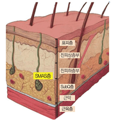 애슬리의원 탄력 리프팅 상세 안내 이미지